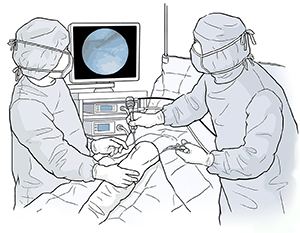 Surgeon arthroscope to operate on a knee.