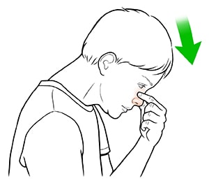 Side view of child leaning head forward and pinching bridge of nose.