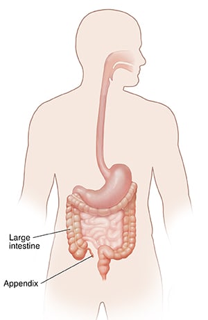 Location of appendix in lower right part of belly area near start of large intestine.