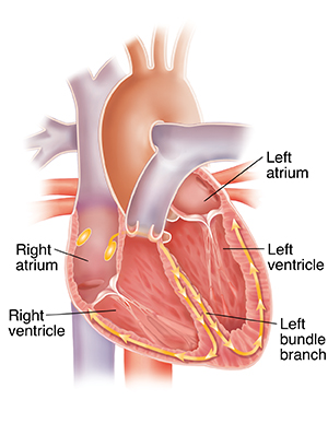 Cross section of heart showing right atrium, left atrium, right ventricle, left ventricle, and left bundle branch.