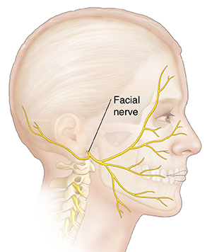 Side view of head showing facial nerve.