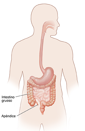 Contorno de un cuerpo masculino donde se ve el sistema digestivo, incluido el apéndice.