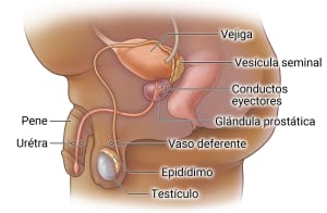 En el aparato reproductor masculino, pueden formarse bloqueos en la uretra, que conecta la vejiga y el pene; el conducto deferente, que se conecta al epidídimo y al testículo; y los conductos eyaculadores, que se superponen a la glándula prostática.